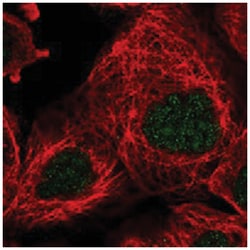 LARP7 Rabbit anti-Human, Polyclonal Antibody, Abnova 100 &mu;L | Buy Online | Abnova Corporation | Fisher Scientific
