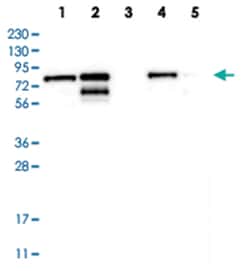 TMTC2 Rabbit anti-Human, Mouse, Rat, Polyclonal Antibody, Abnova 100 &mu;L | Buy Online | Abnova Corporation | Fisher Scientific