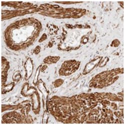 TMTC2 Rabbit anti-Human, Mouse, Rat, Polyclonal Antibody, Abnova 100 &mu;L | Buy Online | Abnova Corporation | Fisher Scientific