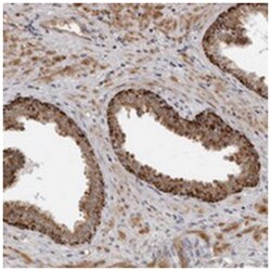 ABCB5 Rabbit anti-Human, Polyclonal Antibody, Abnova 100 &mu;L | Buy Online | Abnova Corporation | Fisher Scientific