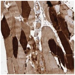 VN1R4, Rabbit, Polyclonal Antibody, Abnova 100 &mu;L | Buy Online | Abnova Corporation | Fisher Scientific