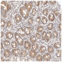 ASCL3, Rabbit, Polyclonal Antibody, Abnova 100 &mu;L | Buy Online | Abnova Corporation | Fisher Scientific
