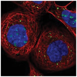 ASCL3, Rabbit, Polyclonal Antibody, Abnova 100 &mu;L | Buy Online | Abnova Corporation | Fisher Scientific