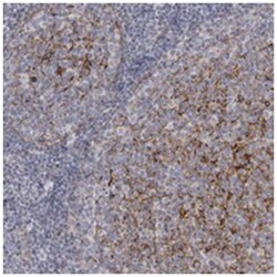 VANGL2, Rabbit, Polyclonal Antibody, Abnova 100&mu;L; Unlabeled:Antibodies,