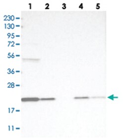 TMEM199, Rabbit, Polyclonal Antibody, Abnova 100&mu;L; Unlabeled:Antibodies,