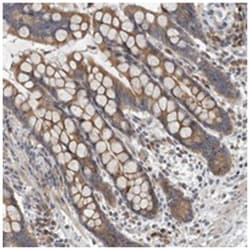 TMEM199, Rabbit, Polyclonal Antibody, Abnova 100&mu;L; Unlabeled:Antibodies,