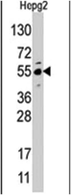 JMJD4 Rabbit anti-Human, Polyclonal Antibody, Abnova 400 &mu;L | Buy Online | Abnova Corporation | Fisher Scientific