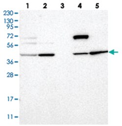 GPER Rabbit anti-Human, Polyclonal Antibody, Abnova 100&mu;L; Unlabeled:Antibodies,