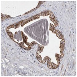 TPCN2, Rabbit, Polyclonal Antibody, Abnova 100 &mu;L | Buy Online | Abnova Corporation | Fisher Scientific