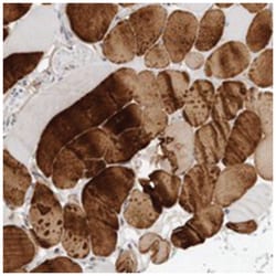 MTERFD2 Rabbit anti-Human, Polyclonal Antibody, Abnova 100 &mu;L | Buy Online | Abnova Corporation | Fisher Scientific