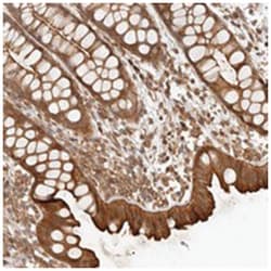 UFSP1 Rabbit anti-Human, Polyclonal Antibody, Abnova 100 &mu;L | Buy Online | Abnova Corporation | Fisher Scientific