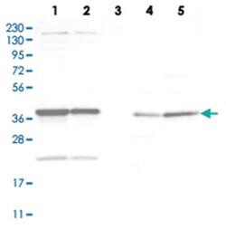ADPRHL2 Rabbit anti-Human, Mouse, Rat, Polyclonal Antibody, Abnova 100 &mu;L | Buy Online | Abnova Corporation | Fisher Scientific