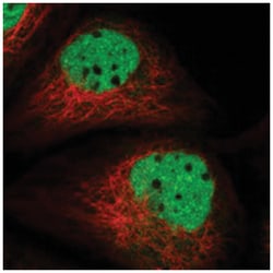 ADPRHL2 Rabbit anti-Human, Mouse, Rat, Polyclonal Antibody, Abnova 100 &mu;L | Buy Online | Abnova Corporation | Fisher Scientific