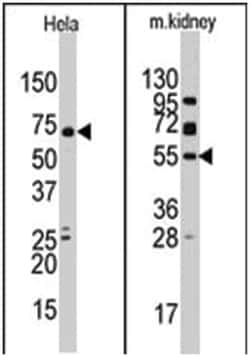 JMJD4 Rabbit anti-Human, Mouse, Polyclonal Antibody, Abnova 400 &mu;L | Buy Online | Abnova Corporation | Fisher Scientific