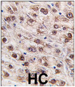 JMJD4 Rabbit anti-Human, Mouse, Polyclonal Antibody, Abnova 400 &mu;L | Buy Online | Abnova Corporation | Fisher Scientific