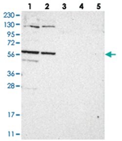 C1orf114 Rabbit anti-Human, Polyclonal Antibody, Abnova 100 &mu;L | Buy Online | Abnova Corporation | Fisher Scientific