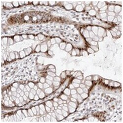 PLEKHG1 Rabbit anti-Human, Polyclonal Antibody, Abnova 100 &mu;L | Buy Online | Abnova Corporation | Fisher Scientific