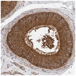 OXR1 Rabbit anti-Human, Polyclonal Antibody, Abnova 100&mu;L; Unlabeled:Antibodies,