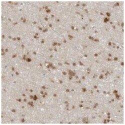 CC2D1B, Rabbit, Polyclonal Antibody, Abnova 100 &mu;L | Buy Online | Abnova Corporation | Fisher Scientific