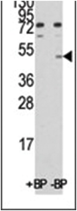 MINA Rabbit anti-Human, Polyclonal Antibody, Abnova 400 &mu;L | Buy Online | Abnova Corporation | Fisher Scientific
