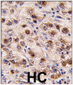 MINA Rabbit anti-Human, Polyclonal Antibody, Abnova 400 &mu;L | Buy Online | Abnova Corporation | Fisher Scientific