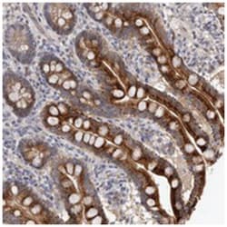 PTAFR, Rabbit, Polyclonal Antibody, Abnova 100&mu;L; Unlabeled:Antibodies,