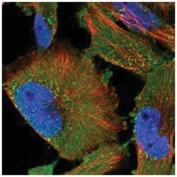 PTAFR, Rabbit, Polyclonal Antibody, Abnova 100&mu;L; Unlabeled:Antibodies,