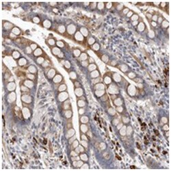 ATXN3L, Rabbit, Polyclonal Antibody, Abnova 100&mu;L; Unlabeled:Antibodies,