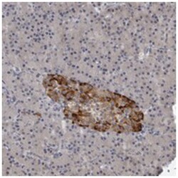 RC3H1 Rabbit anti-Human, Polyclonal Antibody, Abnova 100 &mu;L | Buy Online | Abnova Corporation | Fisher Scientific