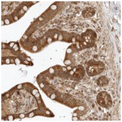 RC3H1 Rabbit anti-Human, Polyclonal Antibody, Abnova 100&mu;L; Unlabeled:Antibodies,