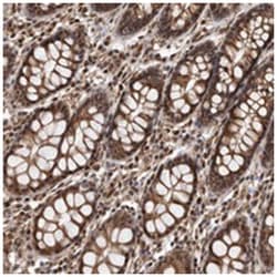 ADAMTS20 Rabbit anti-Human, Polyclonal Antibody, Abnova 100&mu;L; Unlabeled:Antibodies,