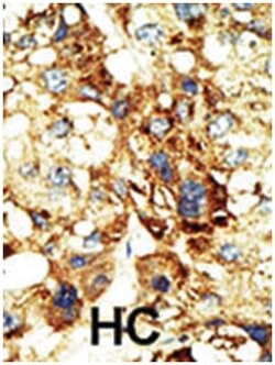 DNMT3A Rabbit anti-Human, Polyclonal Antibody, Abnova 400&mu;L; Unlabeled:Antibodies,