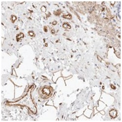 NUS1, Rabbit, Polyclonal Antibody, Abnova 100 &mu;L | Buy Online | Abnova Corporation | Fisher Scientific