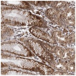 C1orf150, Rabbit, Polyclonal Antibody, Abnova 100&mu;L; Unlabeled:Antibodies,