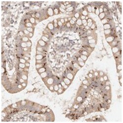 PHLDA3, Rabbit, Polyclonal Antibody, Abnova 100&mu;L; Unlabeled:Antibodies,