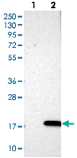 PHLDA3, Rabbit, Polyclonal Antibody, Abnova 100&mu;L; Unlabeled:Antibodies,