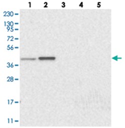C1orf51, Rabbit, Polyclonal Antibody, Abnova 100 &mu;L | Buy Online | Abnova Corporation | Fisher Scientific
