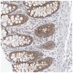 C1orf51, Rabbit, Polyclonal Antibody, Abnova 100 &mu;L | Buy Online | Abnova Corporation | Fisher Scientific