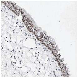 VEZF1, Rabbit, Polyclonal Antibody, Abnova 100 &mu;L | Buy Online | Abnova Corporation | Fisher Scientific