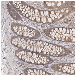 TC2N, Rabbit, Polyclonal Antibody, Abnova 100&mu;L; Unlabeled:Antibodies,