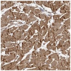SORBS1, Rabbit, Polyclonal Antibody, Abnova 100 &mu;L | Buy Online | Abnova Corporation | Fisher Scientific