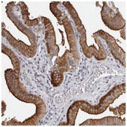 CGN Rabbit anti-Human, Polyclonal Antibody, Abnova 100&mu;L; Unlabeled:Antibodies,