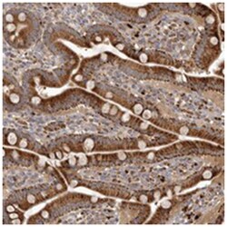 AS3MT Rabbit anti-Human, Polyclonal Antibody, Abnova 100 &mu;L | Buy Online | Abnova Corporation | Fisher Scientific