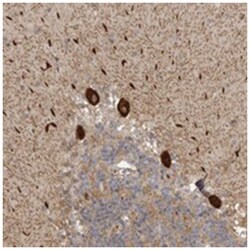 DNAH14, Rabbit, Polyclonal Antibody, Abnova 100&mu;L; Unlabeled:Antibodies,