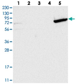 GBP6 Rabbit anti-Human, Polyclonal Antibody, Abnova 100 &mu;L | Buy Online | Abnova Corporation | Fisher Scientific