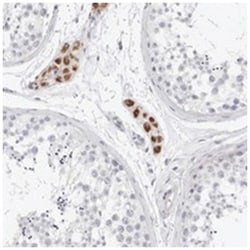 GBP6 Rabbit anti-Human, Polyclonal Antibody, Abnova 100 &mu;L | Buy Online | Abnova Corporation | Fisher Scientific
