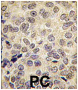 DNMT3B Rabbit anti-Human, Polyclonal Antibody, Abnova 400 &mu;L | Buy Online | Abnova Corporation | Fisher Scientific