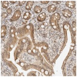 NEO1 Rabbit anti-Human, Polyclonal Antibody, Abnova 100&mu;L; Unlabeled:Antibodies,