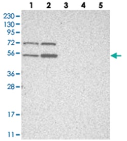 ZNF642, Rabbit, Polyclonal Antibody, Abnova 100&mu;L; Unlabeled:Antibodies,