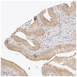 ZNF642, Rabbit, Polyclonal Antibody, Abnova 100&mu;L; Unlabeled:Antibodies,